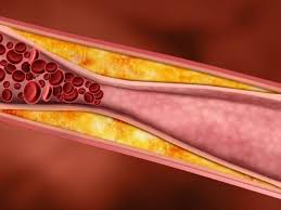 Чому треба перевіряти рівень холестерину і де це зробити безоплатно